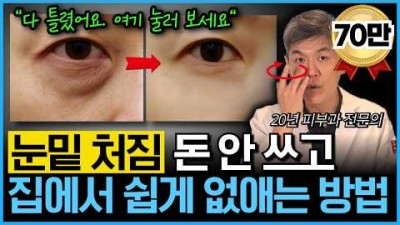 눈밑 지방 없애는 홈케어 방법, 처진 눈밑 지방 관리 방법, 눈밑 지방 없애는 관리 방법 정보